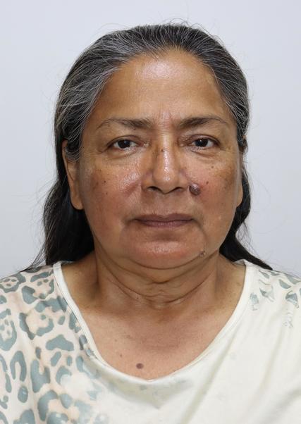 ALDI ALIDA GUERRA TEIXEIRA