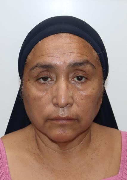 DORIS MORALES ASTETE