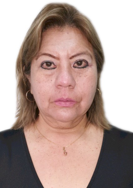 MIRTHA ANA BALDEON LOSTAUNAU