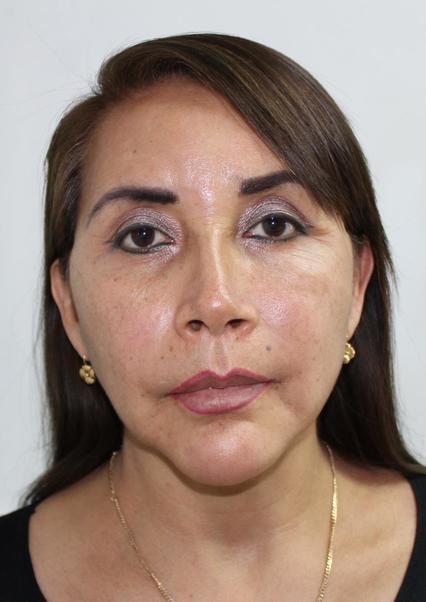 YOVANA PATRICIA DIAZ VEGA