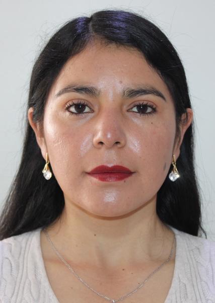 NANCY YCELA LOZANO PERALTA
