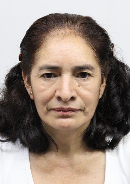 ELVIA NUÑEZ CHACHAPOYAS