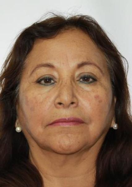 ILDA NANCY BEDOYA VERA