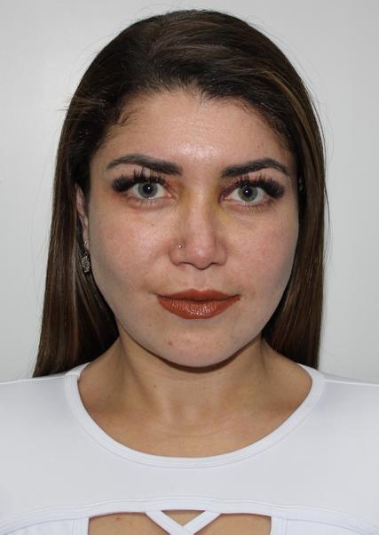 MARIEN CACHAY CHAVEZ