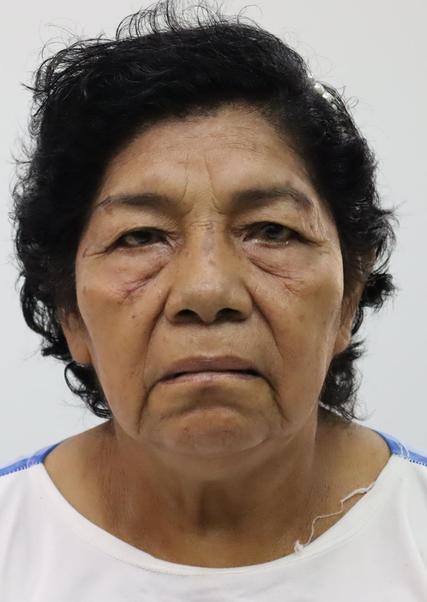 ZOILA TAMINCHI MARTINEZ