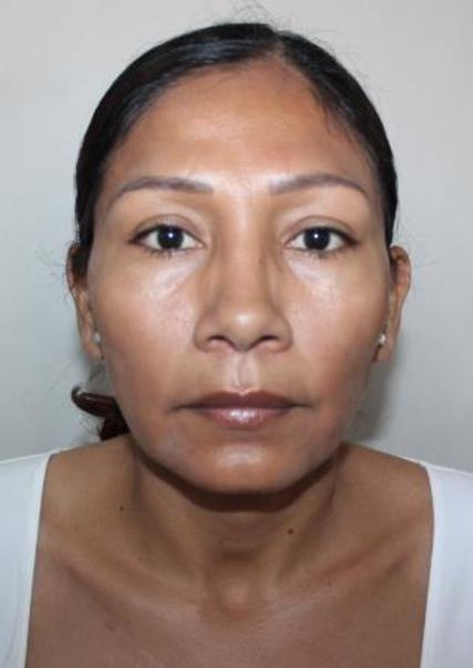 MARTHA GONZA CASTILLO