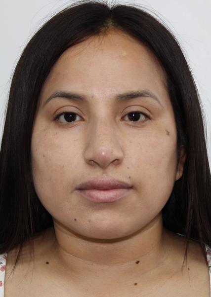 FLOR DEL ROSARIO REYES CRUZ