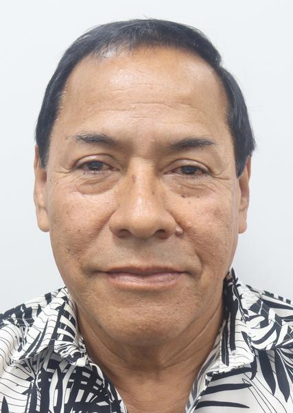 OSCAR JAVIER VEGA REMIGIO