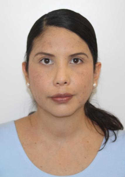 MATILDE LOZADA DEGLANE