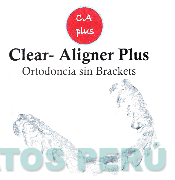 C.A PLUS CLEAR-ALIGNER PLUS ORTODONCIA SIN BRACKETS